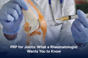PRP for Joints